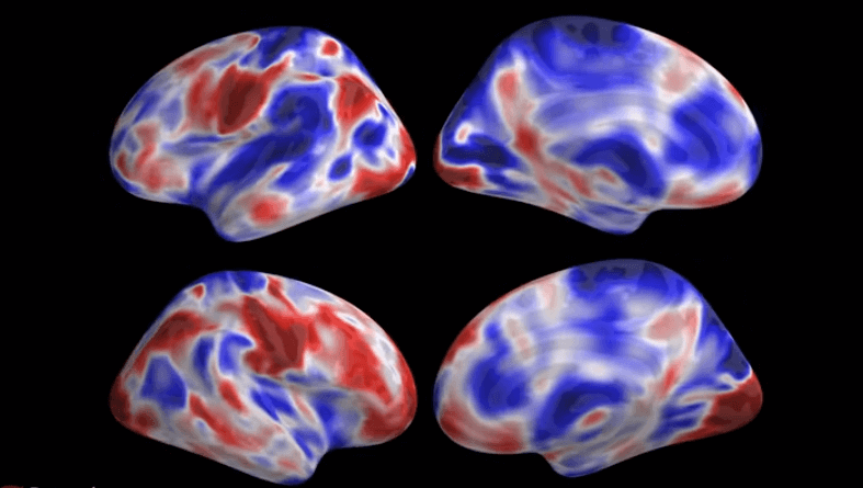 brain activity from MRI scan while someone plays a musical instrument